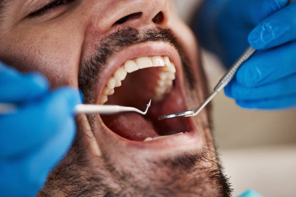 Best Emergency Tooth Extraction in Waterford, WI