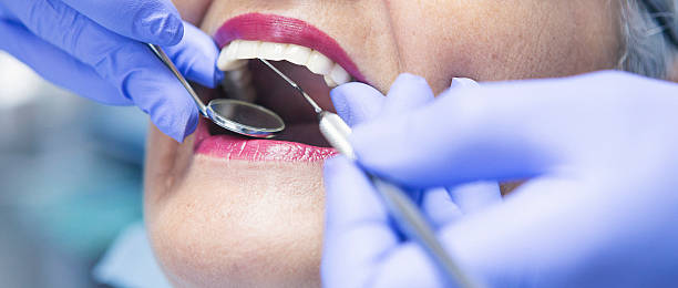 Best Urgent Care for Lost Fillings or Crowns in Waterford, WI